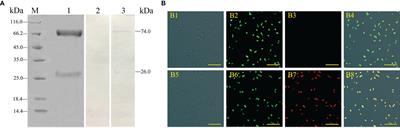 Regulatory Role of Fc Receptor in mIgM+ B Lymphocyte Phagocytosis in Flounder (Paralichthys olivaceus)